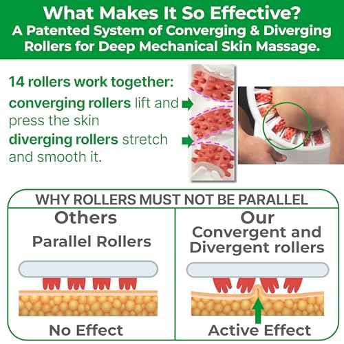 Anti Cellulite Roller & Lymphatic Drainage Massager | Fascia Blaster for Contoured & Smoother Skin | Tool for Sore Arms, Legs, Stomach & Buttocks Multicolor