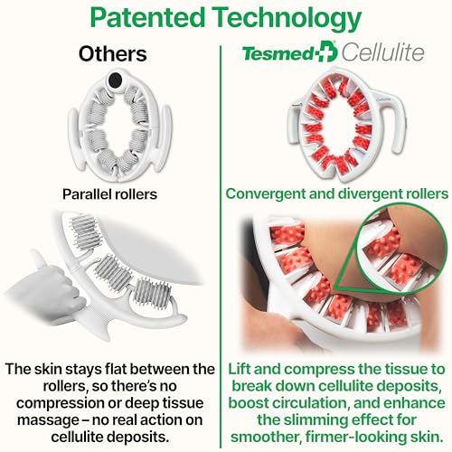 Anti Cellulite Roller & Lymphatic Drainage Massager | Fascia Blaster for Contoured & Smoother Skin | Tool for Sore Arms, Legs, Stomach & Buttocks Multicolor